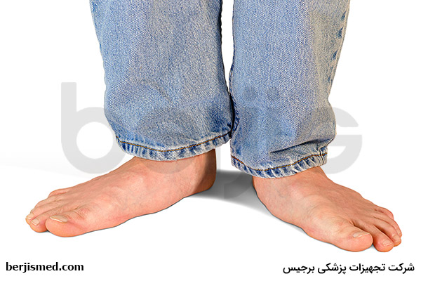آموزش درمان صافی کف پا آموزش درمان صافی کف پا
